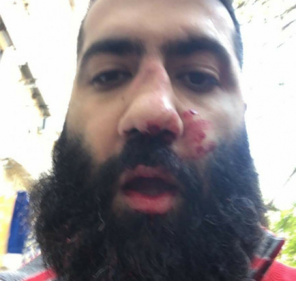 Ալեն Սիմոնյանը հարձակվել է փողոցում զբոսնող Արթուր Դանիելյանի վրա (լուսանկար, տեսանյութ)